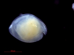 Ostracoda