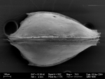 Pseudobosquetina