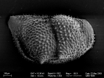 Ostracoda