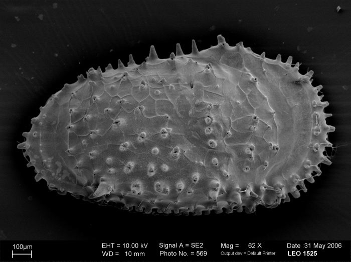 Cytherocopina (Suborder) Cytheroidea (Superfamily) Trachyleberididae (Family) Legitimocythere