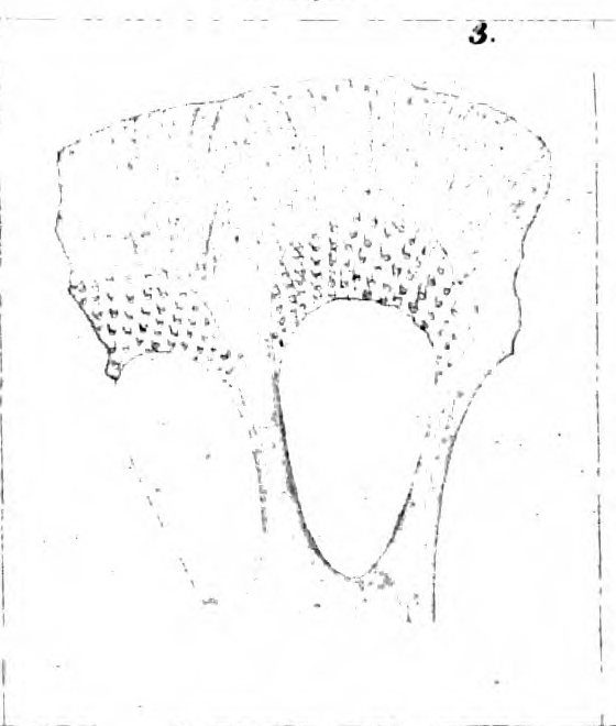 Calcarina nicobarensis Schwager, 1866 Calcarina nicobarensis Schwager, 1866