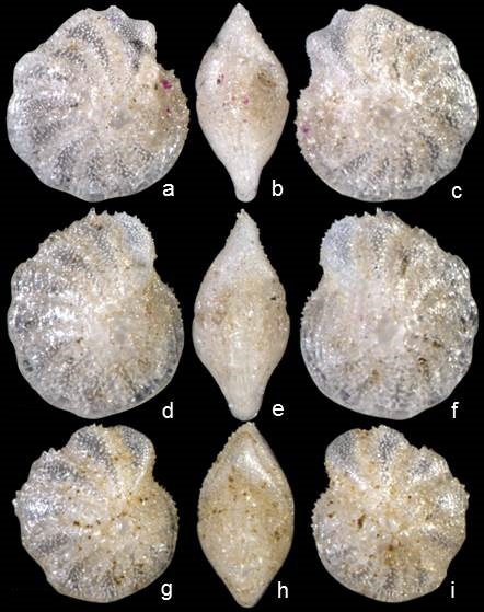 Elphidium jiani Elphidium jiani