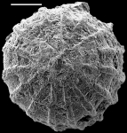 Amphimorphinella butonensis Keyzer, 1953 Identified specimen