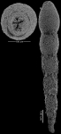 Anastomosa loeblichi Hayward & Van Kerckhoven, 2012 PARATYPE