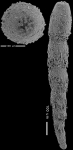 Anastomosa loeblichi Hayward & Van Kerckhoven, 2012 HOLOTYPE
