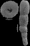 Anastomosa loeblichi Hayward & Van Kerckhoven, 2012 PARATYPE