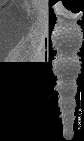 Stilostomella bortanica Hornibrook, 1961, topotype Stilostomella bortanica Hornibrook, 1961, topotype