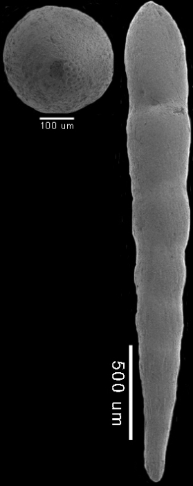 Chrysalogonium ciperense Cushman & Stainforth, 1945 MICROSPHERIC FORM Chrysalogonium ciperense Cushman & Stainforth, 1945 MICROSPHERIC FORM