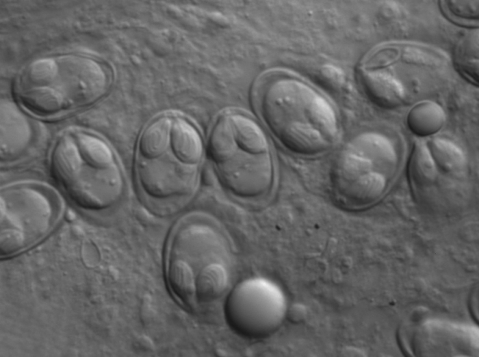 Fresh myxospores of Myxobolus klamathellus from subcutaneous cyst