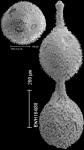 Lotostomoides asperulum (Neugeboren, 1852) IDENTIFIED SPECIMEN