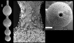 Lotostomoides asperulum (Neugeboren, 1852) IDENTIFIED SPECIMEN