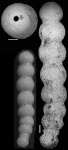 Nodogenerina trincherasensis Bermudez, 1949 HOLOTYPE