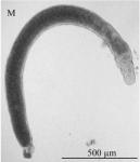 Platyhelminthes