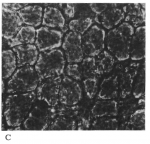 Platyhelminthes