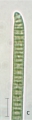 Phormidium uncinatum