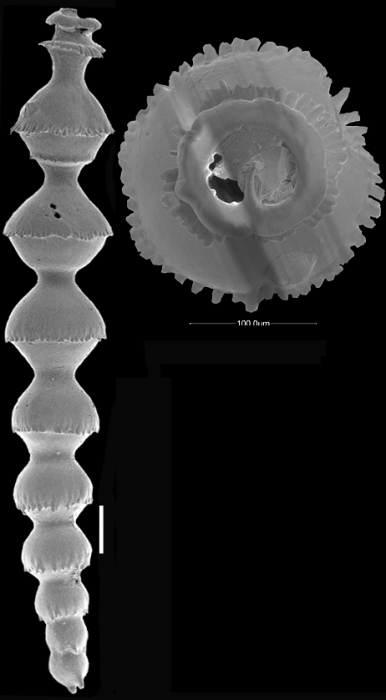 Siphonodosaria campana Hayward & Kawagata, 2012. Paratype Siphonodosaria campana Hayward & Kawagata, 2012. Paratype
