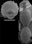 Siphonodosaria lohmani (Kleinpell, 1938) Identified specimen