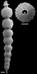 Siphonodosaria subspinosa (Cushman, 1943) Identified specimen