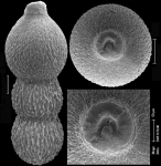 Stilostomella mappa (Cushman & Jarvis, 1934) Identified specimen