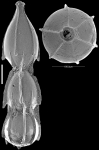 Unidens ishizakii Hayward & Kawagata, 2012, Paratype