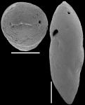 Ellipsoidella pleurostomelloides Heron-Allen & Earland, 1910. Identified specimen