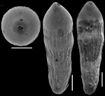 Ellipsoidella tappanae Hayward & Van Kerckhoven, 2012 Paratype