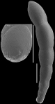 Nodosarella lorifera (Halkyard, 1918). Identified specimen