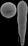 Nodosarella schroederadamsae Hayward, 2012. Paratype