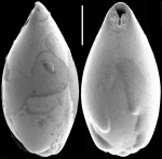 Neopleurostomella polymorpha (Popescu & Crihan, 2005). Identified specimen
