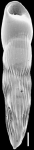 Chromista - Foraminifera (foraminifers)