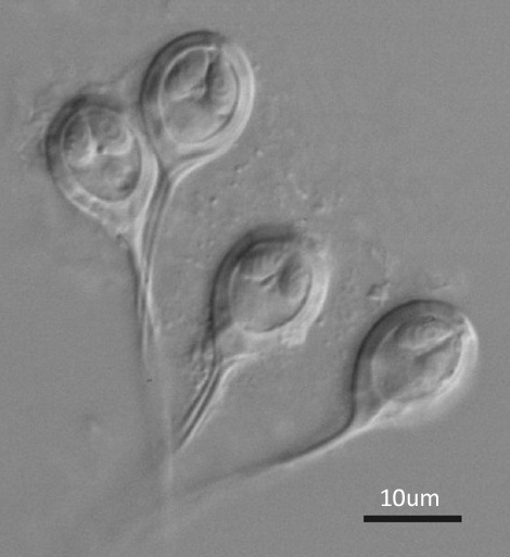 Light micrograph of live spores of Henneguya clini sp. n. from the gills of Clinus superciliosus collected from the Cape south coast, South Africa.