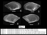 Cytheropteron amphigyum Bergue & Coimbra, 2008 from original description, author: Bergue & Coimbra, 2008 from original description