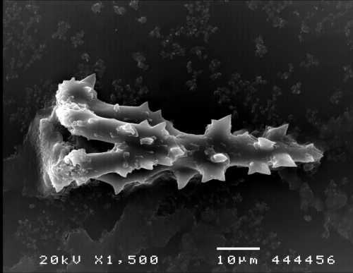 Pearsonothuria graeffei (SEM, spicules) Pearsonothuria graeffei (SEM, spicules)