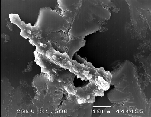 Pearsonothuria graeffei (SEM, spicules) Pearsonothuria graeffei (SEM, spicules)