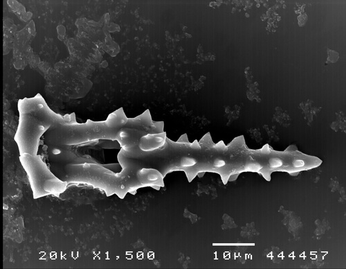 Pearsonothuria graeffei (SEM, spicules) Pearsonothuria graeffei (SEM, spicules)
