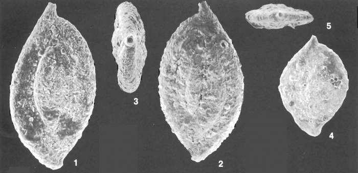 Ammomassilina alveoliniformis (Millett) identified specimen Ammomassilina alveoliniformis (Millett) identified specimen
