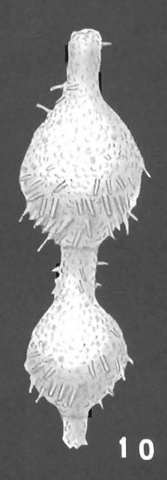 Loeblichopsis spiculifera Hofker identified specimen Loeblichopsis spiculifera Hofker identified specimen