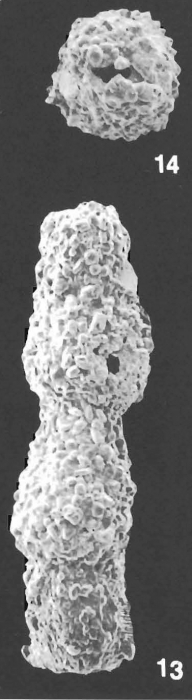 Pseudonodosinella nodulosa (Brady) identified specimen Pseudonodosinella nodulosa (Brady) identified specimen