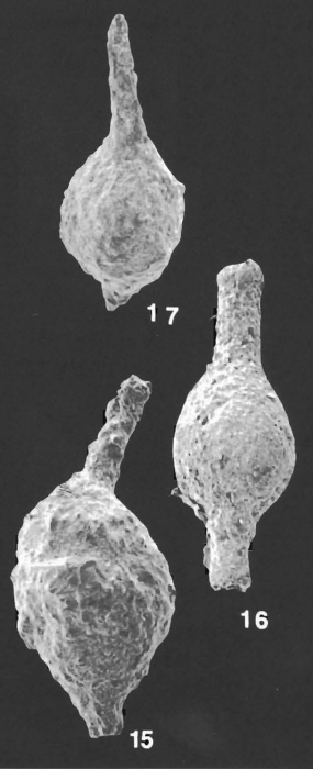 Hormosinella distans (Brady) identified specimen Hormosinella distans (Brady) identified specimen
