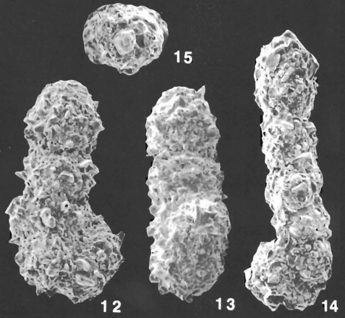 Ammobaculites villosus Saidova identified specimen Ammobaculites villosus Saidova identified specimen