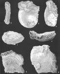 Bdelloidina aggregata Carter identified specimen