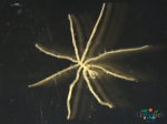 Chelicerata (sea spiders & mites)
