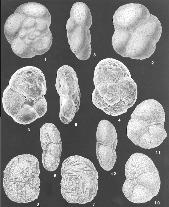Paratrochammina globorotaliformis (Zheng) identified specimens Paratrochammina globorotaliformis (Zheng) identified specimens