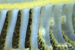 Ptilosarcoma athyrmata