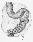 Calcivertella adherens Cushman & Waters, 1928