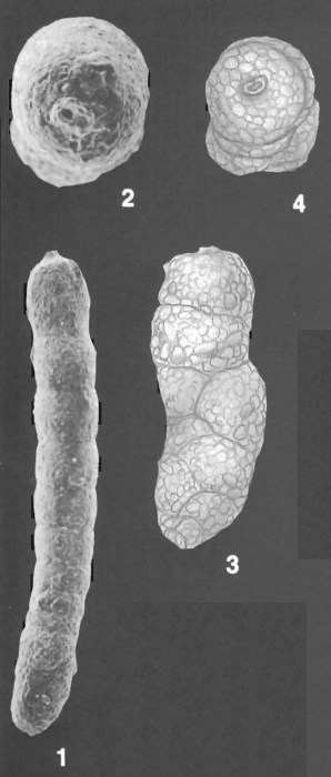 Martinottiella bradyana (Cushman) identified specimens Martinottiella bradyana (Cushman) identified specimens