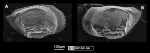 Ostracoda