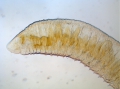 Haemonais waldvogeli (anterior)