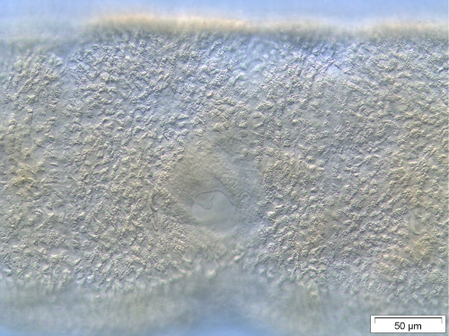 Stylodrilus brachystylus (penis) Stylodrilus brachystylus (penis)