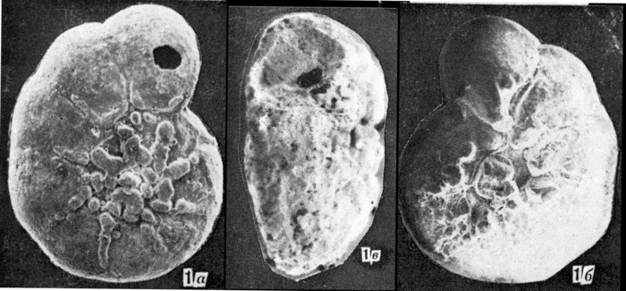 Ammonia agoiensis Yanko, 1990 Holotype Ammonia agoiensis Yanko, 1990 Holotype